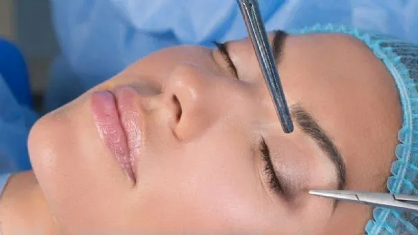 Blefaroplastia: Enfoques Innovadores en Medicina Estética